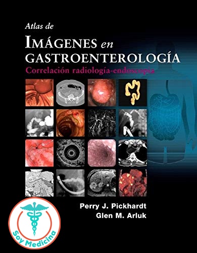 Atlas de Imágenes en Gastroenterología: Correlación Radiología-Endoscopia