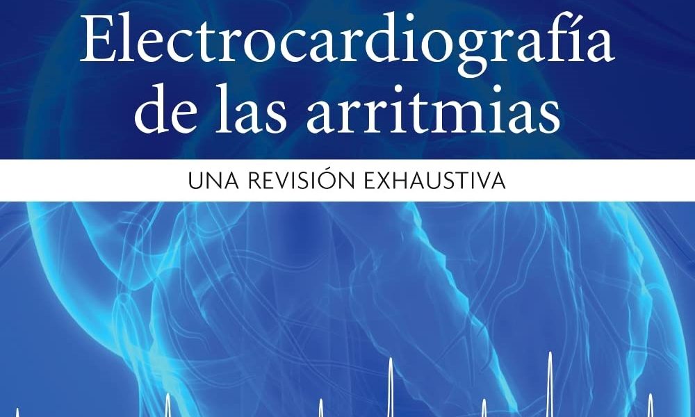 Electrocardiografía de las Arritmias - 2 Edicion