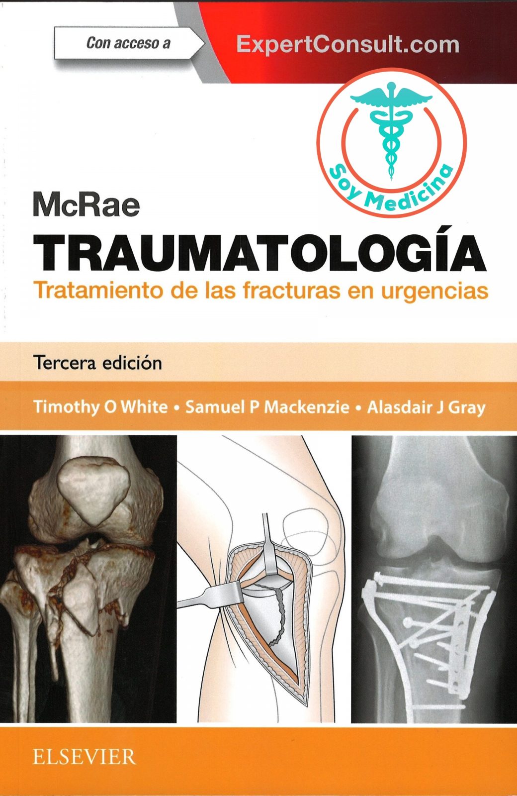 McRae Traumatología Tratamiento de las Fracturas en Urgencias - 3 Edicion