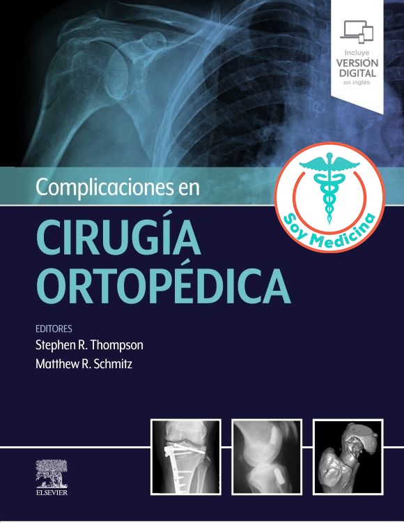 Complicaciones en Cirugía Ortopédica